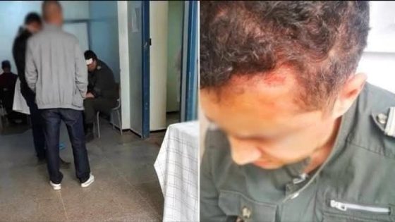 اعتداء مختل عقلي على قائد بجماعة أوفوس يُثير استياء واسعًا