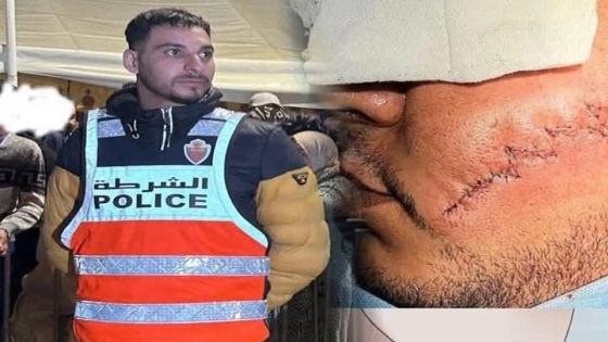 تضحية بطولية.. شرطي سلا زكرياء يواجه الخطر بكل شجاعة