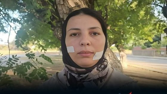 القنيطرة.. الحكم استئنافياً بسنتين ونصف حبسا نافذاً و20 مليون سنتيم تعويضاً على المتهم بتشويه وجه خديجة