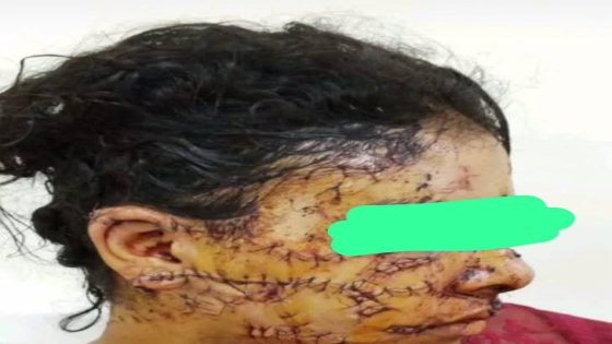 تازة: طليق يعرض شابة لعنف وحشي أمام أنظار المارة… وغياب الردع يطرح أكثر من سؤال