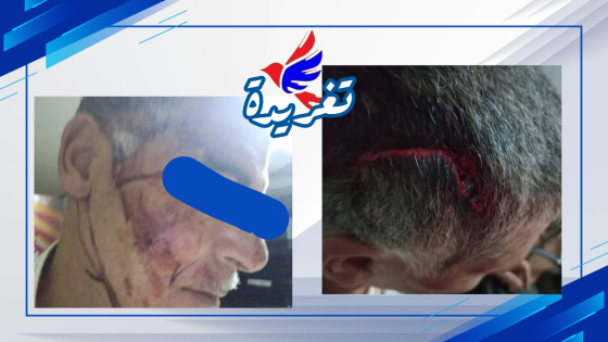 العرائش.. سانديك عمارة يعتدي على أحد السكان في واقعة عنف خطيرة