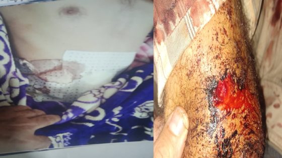 دوار الرملة ببني جرفط: شجار حول رعي الأغنام يتحول إلى مواجهة دامية